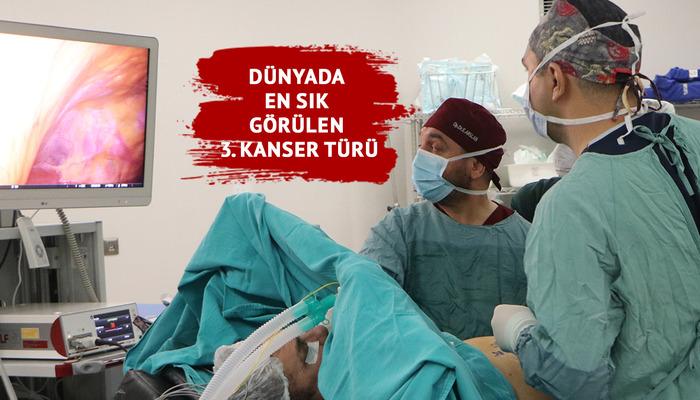 Dünyada en sık görülen 3. tehlikeli hastalık: Kolorektal kanseri... Uzmanlar uyarıyor: 20'li yaşlara kadar indi, çok fazla artmış durumda"